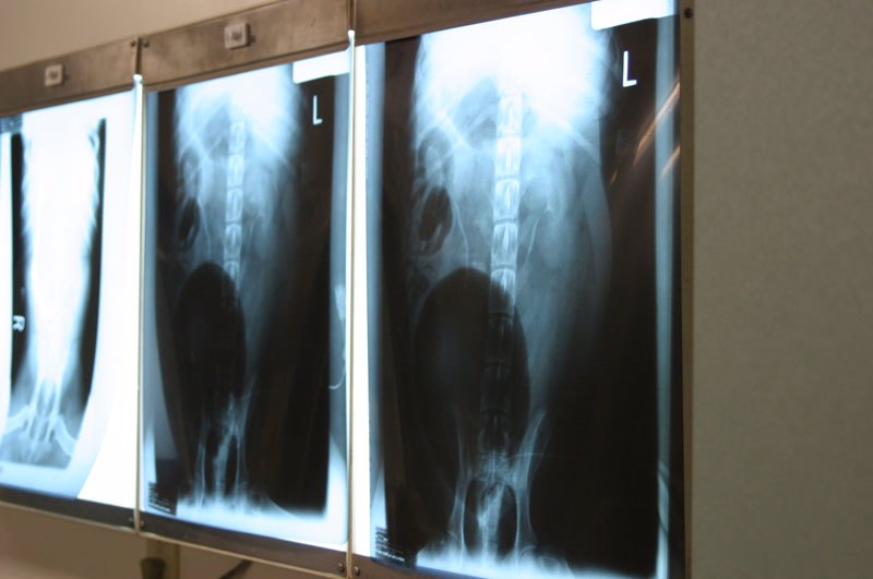 X-rays on Light Box